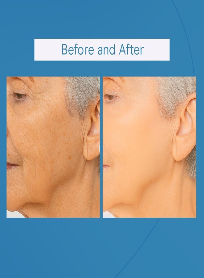 بيبادي سيروم بايبودي المتكامل للوجه، سيروم نياسيناميد لطيف مع حمض الساليسيليك وحمض الهيالورونيك، مناسب لجميع أنواع البشرة، 30 مل - Image 5